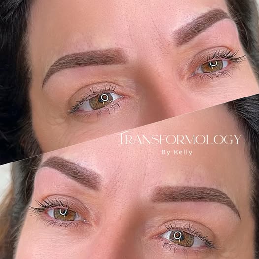 Brow Correction